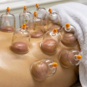 Myofascial Dry Cupping